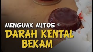 MENGUAK MITOS DARAH KENTAL BEKAM [upl. by Vincenta855]