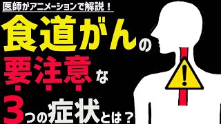 絶対に見逃してはならない食道がんの症状3選 [upl. by Serafina]