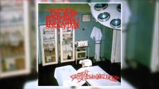 Dead Infection  Surgical Disembowelment 1993 FULL ALBUM [upl. by Twedy]