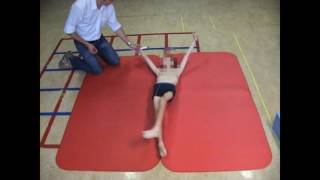 Dyskinetic cerebral palsy case 3 [upl. by Qulllon]