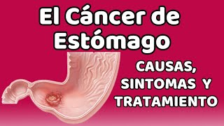 EL CÁNCER DE ESTÓMAGO Causas signos y síntomas diagnóstico y tratamiento [upl. by Neiviv]