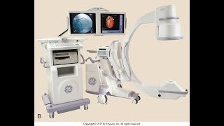 The X Ray Imaging System A [upl. by Seve]