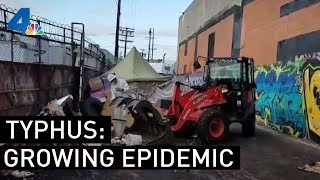 Typhus Epidemic Worsens in Los Angeles  NBCLA [upl. by Nol]