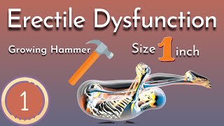 Yoga for Erectile Dysfunction  Part 1  Growing Hammer 🔨 [upl. by Winstonn]