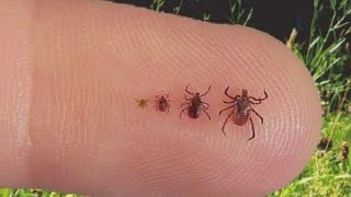 Doctor explains what you should know about ticks [upl. by Eaneg]