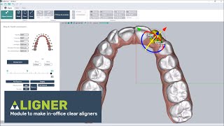 Clear aligner software thermoforming or direct printing [upl. by Schaumberger]