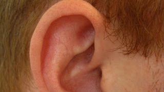 Determine If Ear Cartilage Is Infected  Ear Problems [upl. by Amluz]