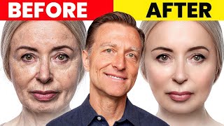 The Ultimate Face Transformation–Dr Bergs Best Remedy for Dry Skin and Wrinkles [upl. by Otreblig]