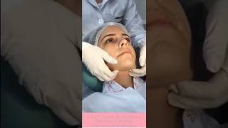 Exame fisico intra e extra oral Bruna Melo e Carolina Dinali [upl. by Yuma]