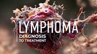 Exploring Lymphoma Treatment Options [upl. by Loreen635]