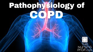 Pathophysiology of COPD [upl. by Acisse]