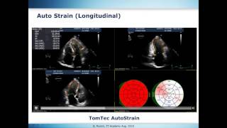 Strain Standardization [upl. by Manny]