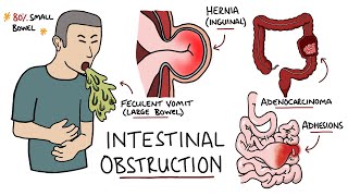 Anatomy Dissection of the Small Intestine Jejunum amp Ileum [upl. by Peednus]