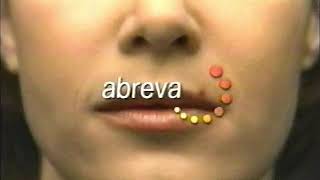 Abreva 2002 Television Commercial [upl. by Vachel182]