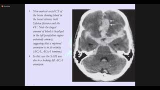 Stem Cell Research for Neurological Diseases  Dr Piotr Walczak  Maryland Stem Cell Research Fund [upl. by Fugazy714]