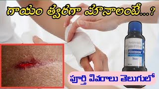 Povidone Iodine Solution Uses In Telugu  Antiseptic  Microbicidal Solution [upl. by Faro628]