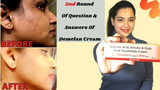 DEMELAN CREAM REVIEW  हिंदी में  My 1 Month Experience With Demelan Cream  Skin Lightening Cream [upl. by Cedell]