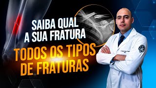 TIPOS DE FRATURA  SAIBA QUAL É A SUA FRATURA [upl. by Anrapa332]