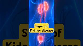 Signs of Kidney Disease Kidney disease health [upl. by Mali483]