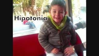 VIDEO DUPLICACION MECP2 [upl. by Nospmas]