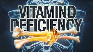 10 WARNING Signs of Vitamin D Deficiency [upl. by Schnapp]