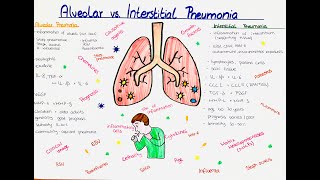 Alveolar vs Interstitial Pneumonia comparison [upl. by Mark]