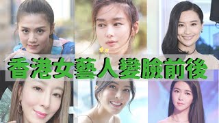 23位香港女星整容前後 原來她她她也有變臉？成功vs失敗案例 [upl. by Hands850]