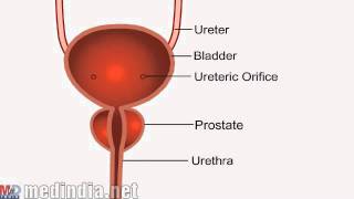 What Is Chyluria [upl. by Etz]