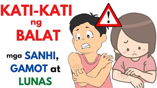 Gamot sa KATI KATI sa BALAT  Epektibong Ointment Halamang Gamot at iba pa para sa makating BALAT [upl. by Brook]