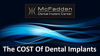 Difference Between AllOn4 and Implant Bridges [upl. by Clark]