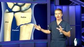 Wrist Fracture Surgery [upl. by Kathryne]