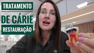 TRATAMENTO DE CÁRIE  RESTAURAÇÃO  DRA DANIELLE SALES [upl. by Lukey]