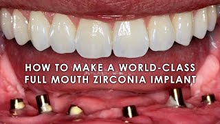 How to make a WorldClass Full Mouth Zirconia Implant [upl. by Aicilet]