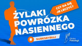 Żylaki powrózka nasiennego  czy da się je leczyć [upl. by Gillett929]