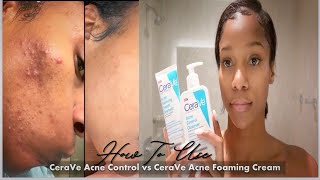 How to use✨ CeraVe Acne Control Cleanser vs CeraVe Acne Foaming Cream Cleanser 🙌🏾 30 Day Review [upl. by Fong307]