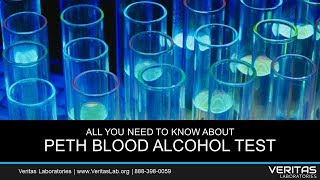 PETH Blood Alcohol Test All You Need to Know FAQ [upl. by Anatak]