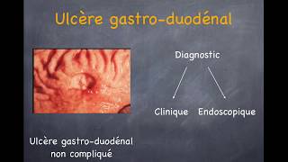 Ulcère gastrique et duodénal Gastrite [upl. by Gievlos]