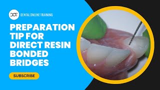 Preparation Tip for Direct Resin Bonded Bridges [upl. by Nilok641]