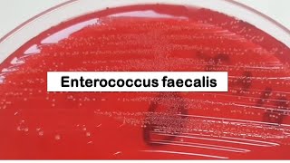 Enterococcus faecalis Colony Morphology on CLED Agar [upl. by Carmelo]