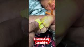 New born baby cannulation ivcannulation mbbs ivinsertion SMpharmacy subscribe [upl. by Ycinuq]