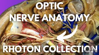 Optic Nerve Neuroanatomy Simplified Rhoton Collection [upl. by Carmel]