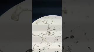 Zooplankton found in pond water biology microscopevideo [upl. by Chill]