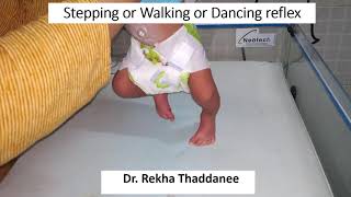 Neonatal Reflex  Stepping Reflex  Walking Reflex  Dancing Reflex I Pediatrics [upl. by Ettenauq]