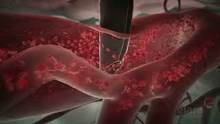 Malaria 3D Animation Shows How the Infection Spreads in the Body [upl. by Adelheid331]