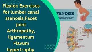 Flexion Exercises For lumber Canal stenosisFacet Joint Arthropathy ligamentum Flavum Hypertrophy [upl. by Glass]