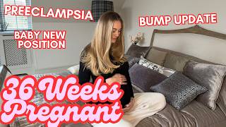 36 Weeks Pregnancy Update Vlog Preeclampsia Baby’s New Position Birth Plan 3rd Trimester 8 months [upl. by Anitirhc]