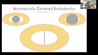 CE Webinar Anatomically Centered Endodontics with Dr Chafic Safi [upl. by Sidoeht774]