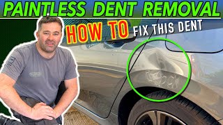 DENTS No Problem Watch the BEST Step by Step Guide On PDR [upl. by Mirna]