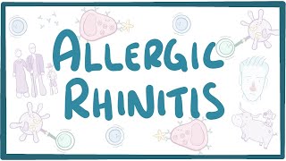 Allergic Rhinitis  causes symptoms diagnosis treatment pathology [upl. by Ariait]