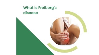 What is Freibergs disease [upl. by Artkele37]